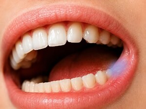 Targeted Oral Care