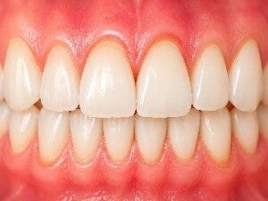 Gentle Gum Care