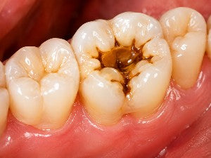 Cavity Sensitivity