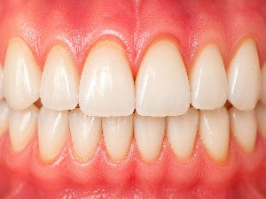 Cavity Discomfort